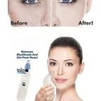 Derma Suction 5 In 1 Black Head Remover Machine Acne Pimple Pore Cleaner Vacuum Tool Rechargeable Machine